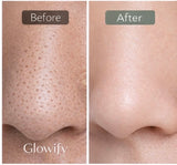 Glowify® Pore Vacuum Pro