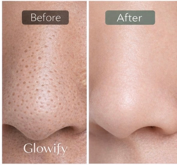 Glowify® Pore Vacuum Pro